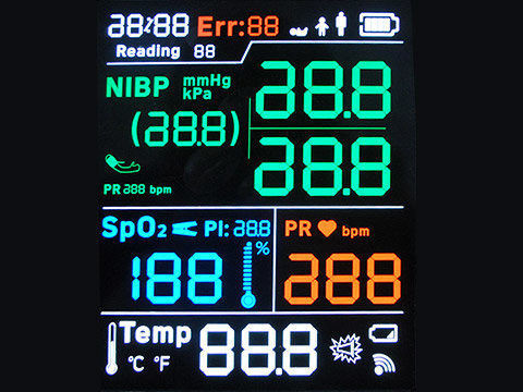 12864 Stn RoHS FSTN 포지티브 LCD 디스플레이 입력 배터리용 1/9 의무